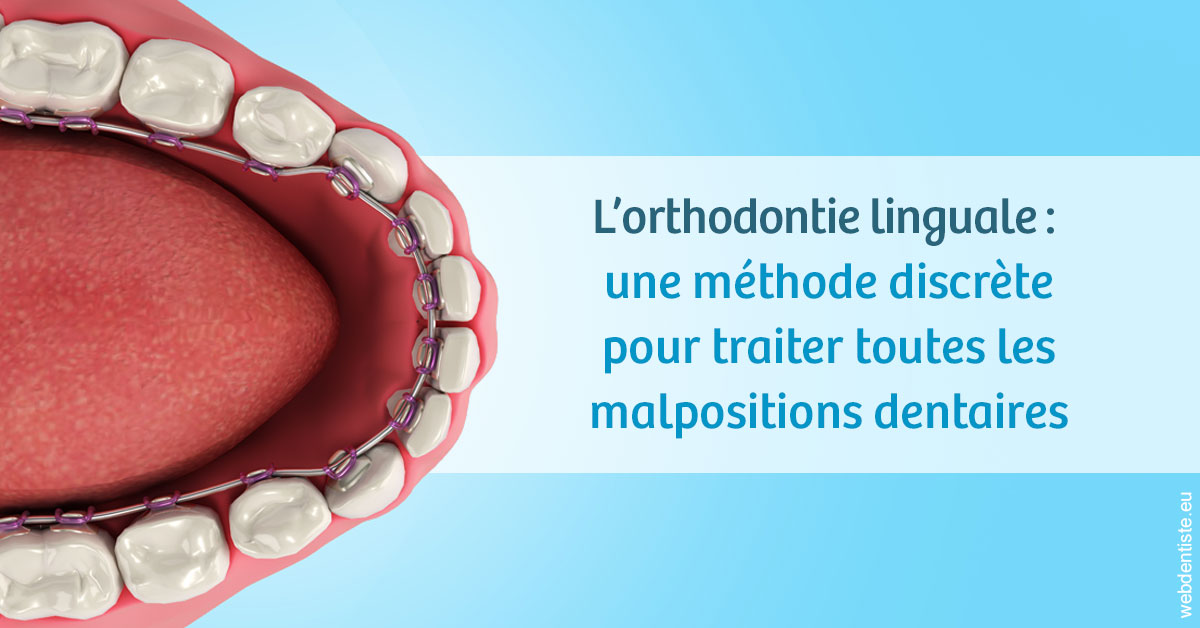 https://www.dentistes-haut-lac.ch/L'orthodontie linguale 1