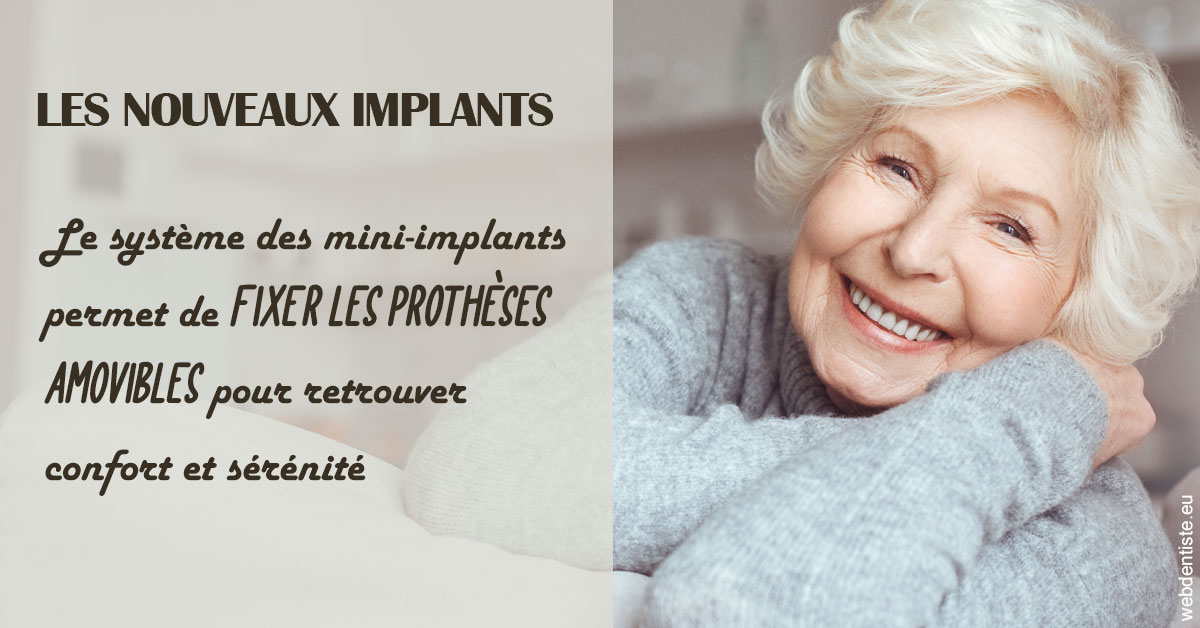 https://www.dentistes-haut-lac.ch/Les nouveaux implants 1