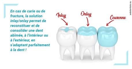 https://www.dentistes-haut-lac.ch/L'INLAY ou l'ONLAY