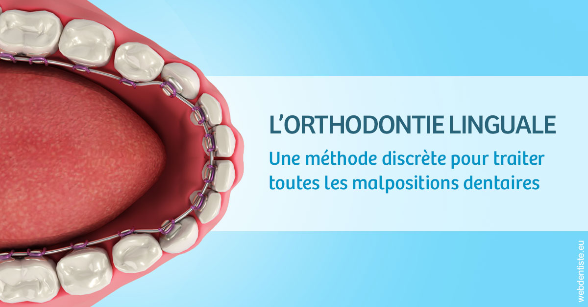 https://www.dentistes-haut-lac.ch/L'orthodontie linguale 1