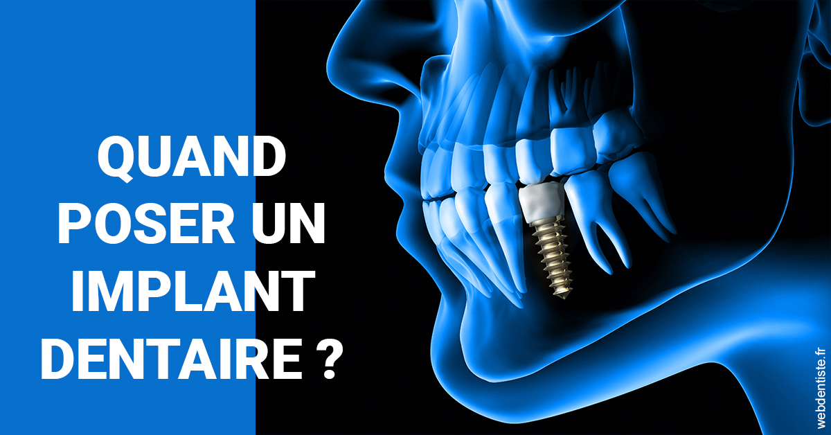 https://www.dentistes-haut-lac.ch/Les implants 1