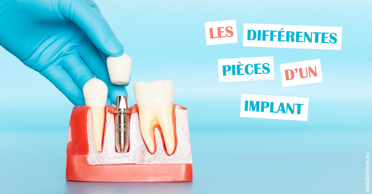 https://www.dentistes-haut-lac.ch/Les différentes pièces d’un implant 2