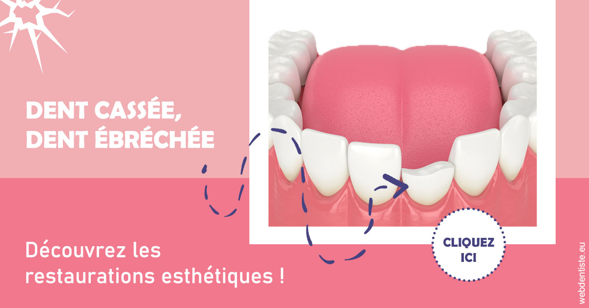 https://www.dentistes-haut-lac.ch/Dent cassée ébréchée 1