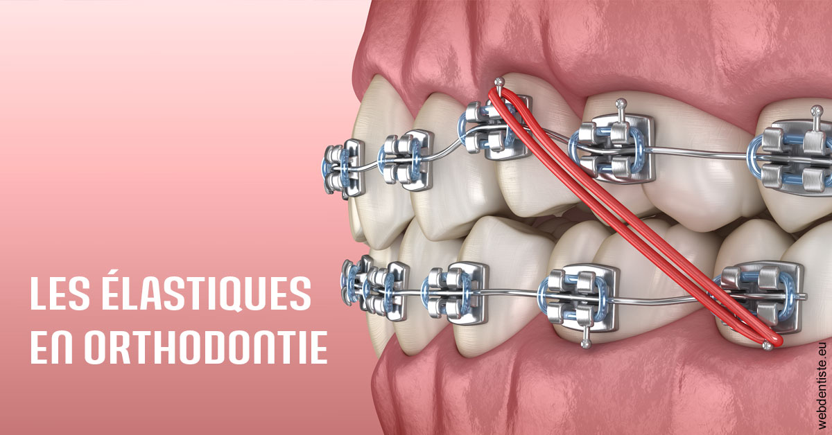 https://www.dentistes-haut-lac.ch/Elastiques orthodontie 2