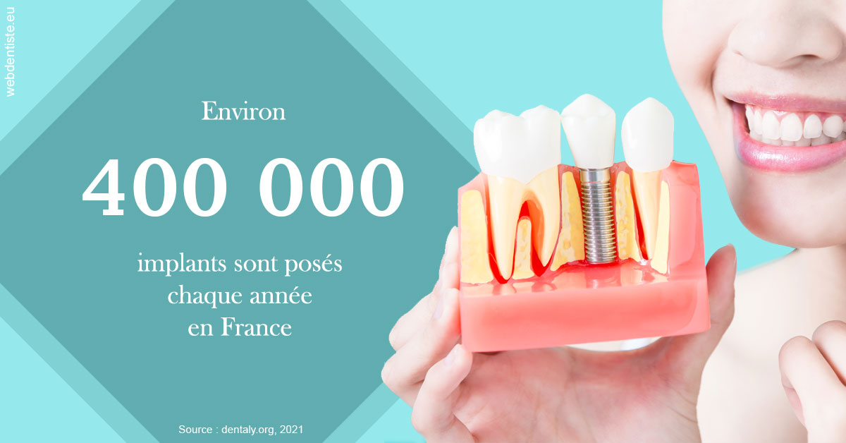 https://www.dentistes-haut-lac.ch/Pose d'implants en France 2