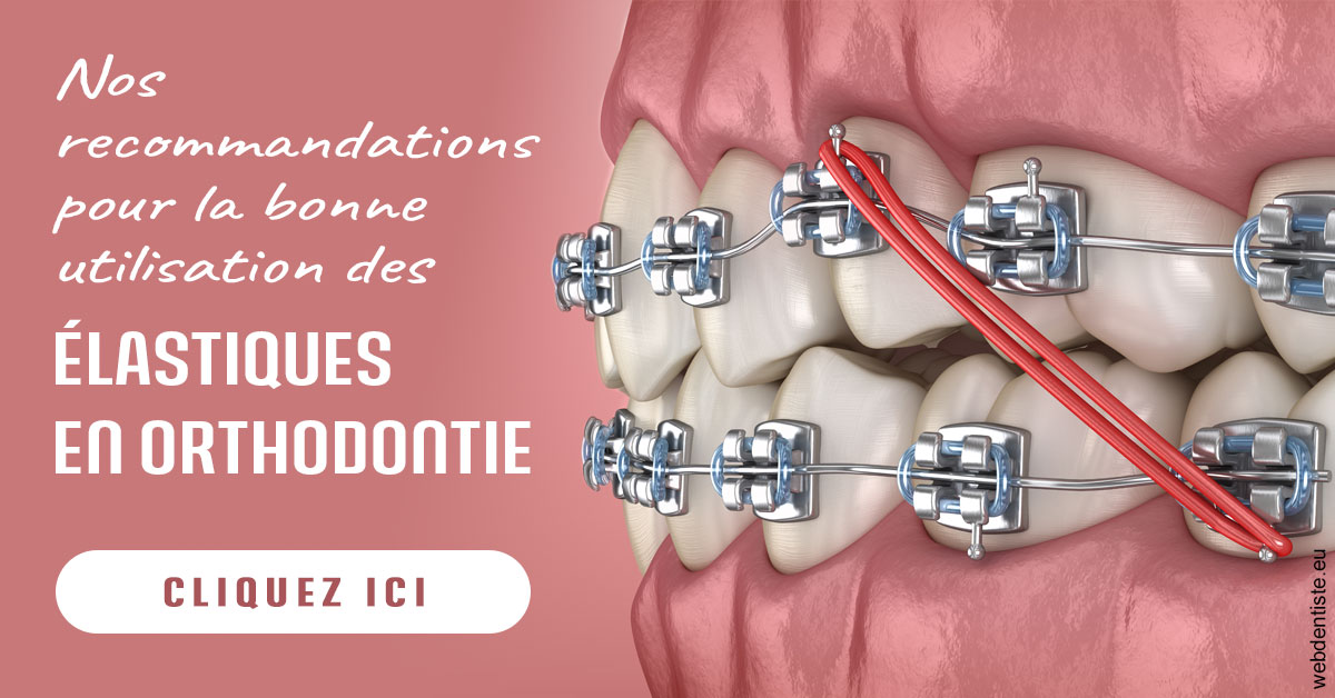 https://www.dentistes-haut-lac.ch/Elastiques orthodontie 2