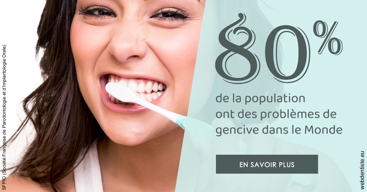 https://www.dentistes-haut-lac.ch/Problèmes de gencive 1