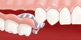 prothèse dentaire 401_1